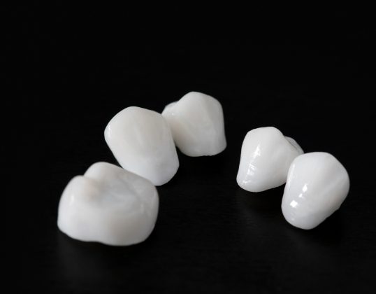 All ceramic dental restorations prior to placement