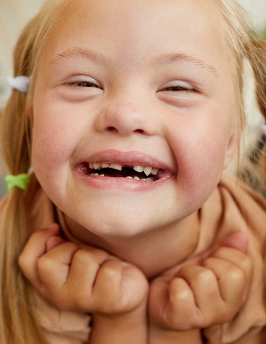 Little girl smiling with Down syndrome after receiving special needs dentistry in Castle Rock