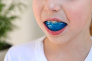 Nose to chin view of a child wearing a blue mouthguard