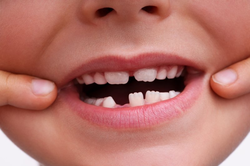 up-close view of child with a missing tooth